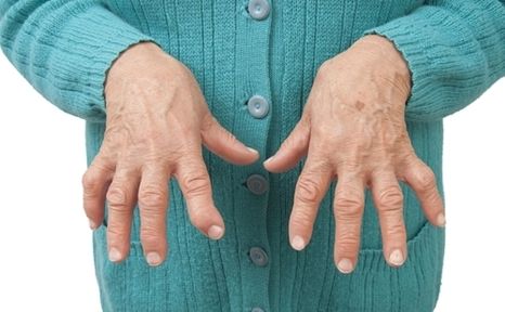 Get to Know Your Arthritis Pain