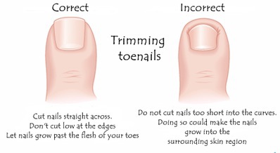 How to cut toenails