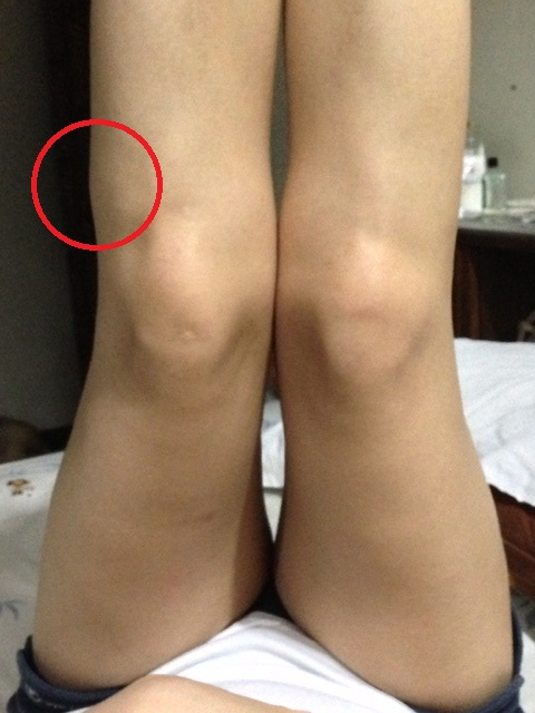 Photo from front of legs