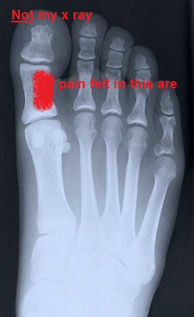 toe image