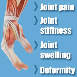Symptoms of arthritis in fingers
