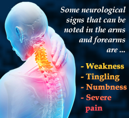 Signs of neck arthritis