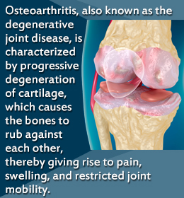 Osteoarthritis - a degenerative joint disease