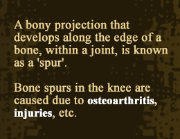 Bone spurs in the knee