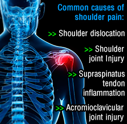 Causes of shoulder pain when lifting arm