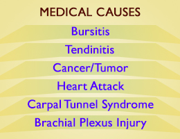 Causes of aching arms