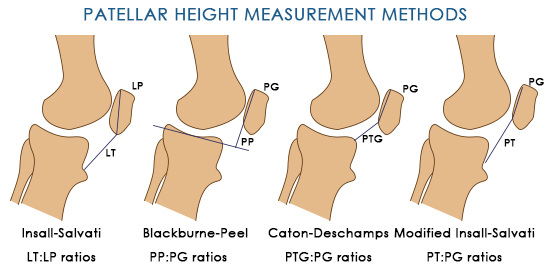 Patella measurement