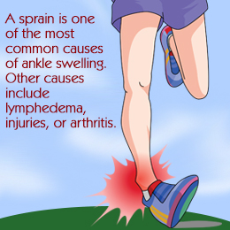 Causes of swollen ankles