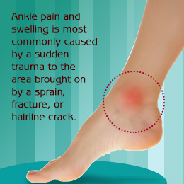Cause of ankle pain and swelling