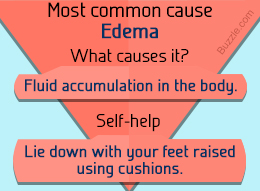 Causes of swollen ankles in the elderly