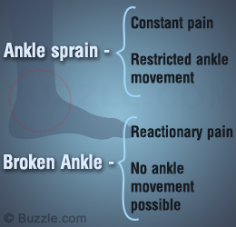 Ankle Sprain or Fracture - How to Tell the Difference
