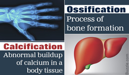 Difference between ossification and calcification