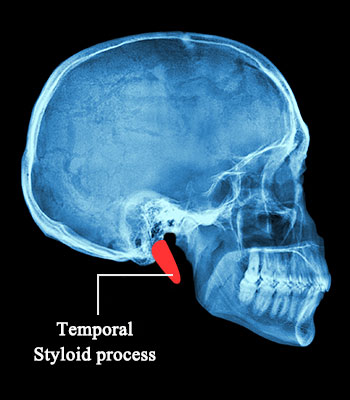 Temporal Bone Structure