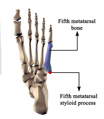 Fifth Metatarsal Bone structure