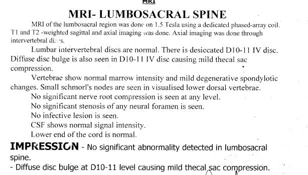 Scan MRI