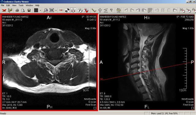 MRI