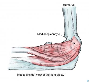 Medial epicondyle. 