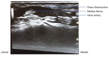 Short-Axis View 