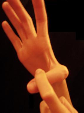 Hand position used for testing if laxity is presen