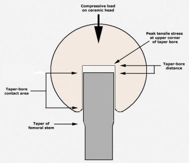 Modular junction between femoral head and stem tap