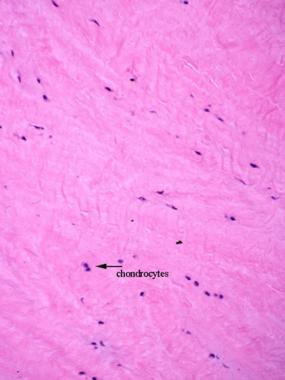 The meniscus is composed of fibrocartilage. 