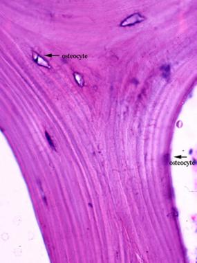 Mature trabecular bone exhibits lamellae and osteo