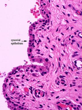 Primary calcification center of fetal bone. 