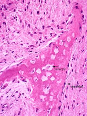 Intramembranous ossification. Woven bone arises di