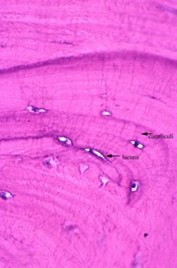 Osteocytes are present in lacunae; their cytoplasm