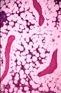 Trabecular bone and the surrounding hematopoietic 