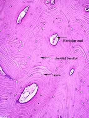 Cortical bone is composed of haversian systems (os