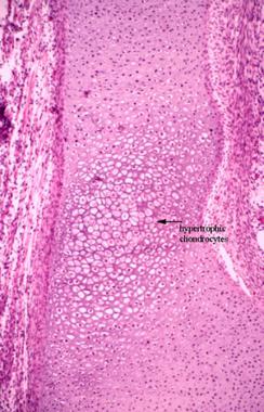 Endochondral ossification in a primary ossificatio