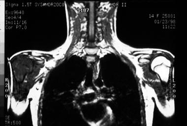 Coronal, T1-weighted magnetic resonance imaging (M