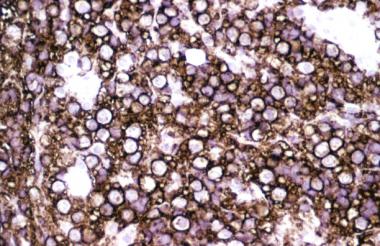 Immunohistochemical stain using an antibody agains