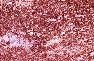 An immunohistochemical stain using an antibody dir