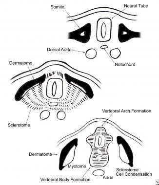 Ventromedial cells of the sclerotome migrate towar