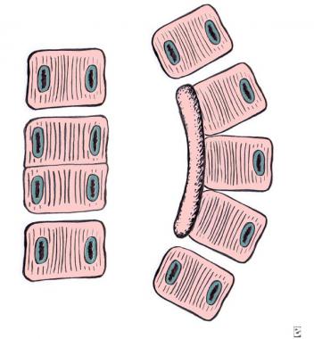 Failure of segmentation. Left: block vertebra. Rig