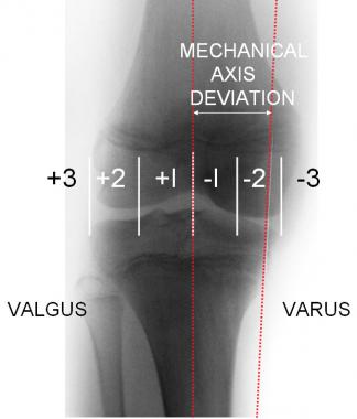 If knee is divided into quadrants and variations o