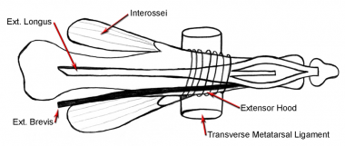 Claw toe. Extensor tendon splits into 3 parts dist