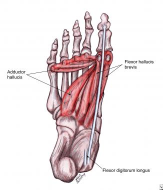 Plantar muscles that contribute to deforming force