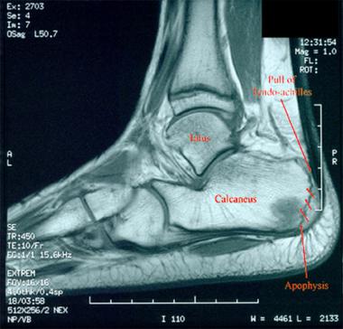 Labeled MRI depicts the anatomy and mechanical for