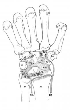 (Click image to enlarge.) Volar carpal ligaments. 