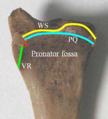 Volar anatomic landmarks important for volar appro