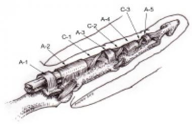 Retinacular portion of flexor tendon sheath. 