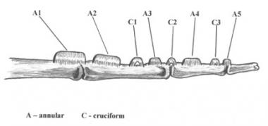 Location of annular and cruciform pulleys on the v