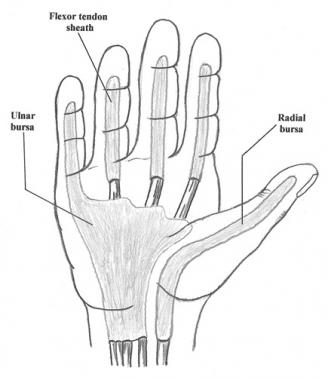 Flexor tendon sheaths and radial and ulnar bursae.