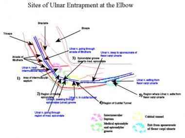 Schematic diagram of elbow region, with 5 main sit