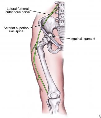 Anatomy of the lateral femoral cutaneous nerve. 