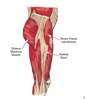 Lateral hip stabilizers. 