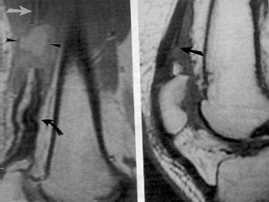 Magnetic resonance imaging (MRI) scans of complete